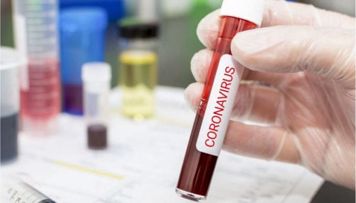 azerbaycanda-koronavirus-ile-bagli-son-veziyyet-aciqlandi